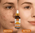 🍊 Vitamin C Daily Serum – Brighten, Repair & Glow Naturally