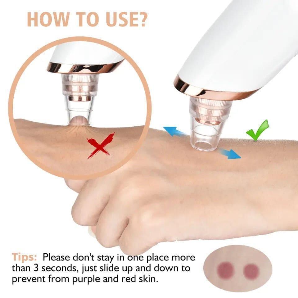 ✨ Electric Blackhead Remover – Deep Pore Cleaner & Skin Refresher